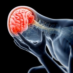 Neurological Issues After a Car Accident