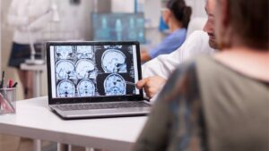 Meridian Brain Injury Attorney