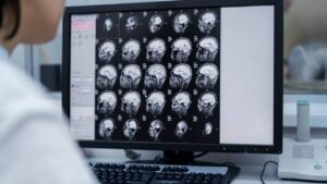 Caldwell Brain Injury Attorney