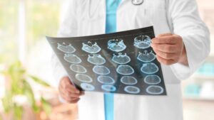 Hayden Traumatic Brain Injury Attorney