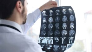 Wildomar Traumatic Brain Injury Attorney